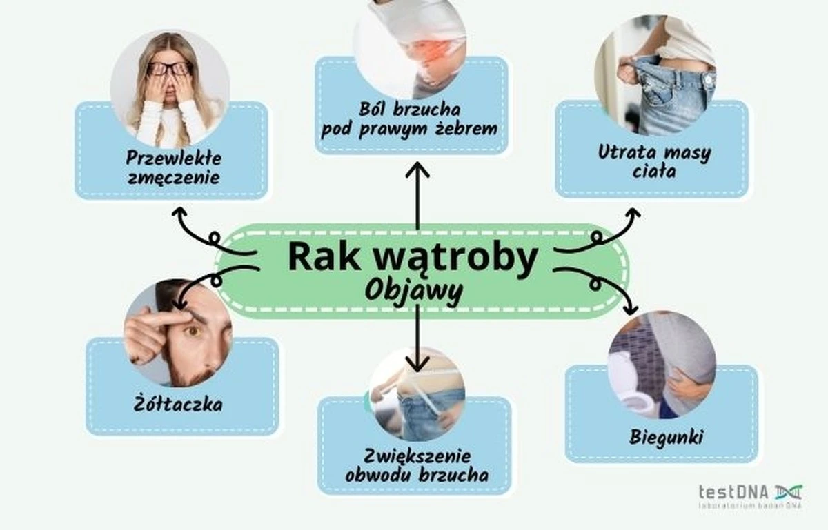 Lekarze biją na alarm: Objawy raka u osób poniżej 50. roku życia, których nie wolno ignorować - image 1