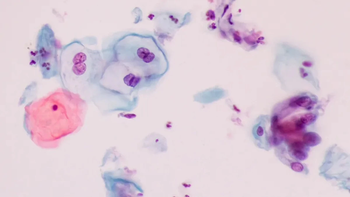 O HPV: Ten wirus, który możesz mieć, nie wiedząc o tym. Jak chroni płodność i przed czym ostrzega ginekolog?