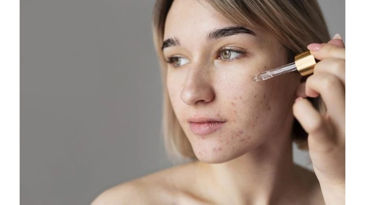 Dermatolog pyta, gdy słyszy o moich metodach na trądzik: „Kto ci tak doradził?”
