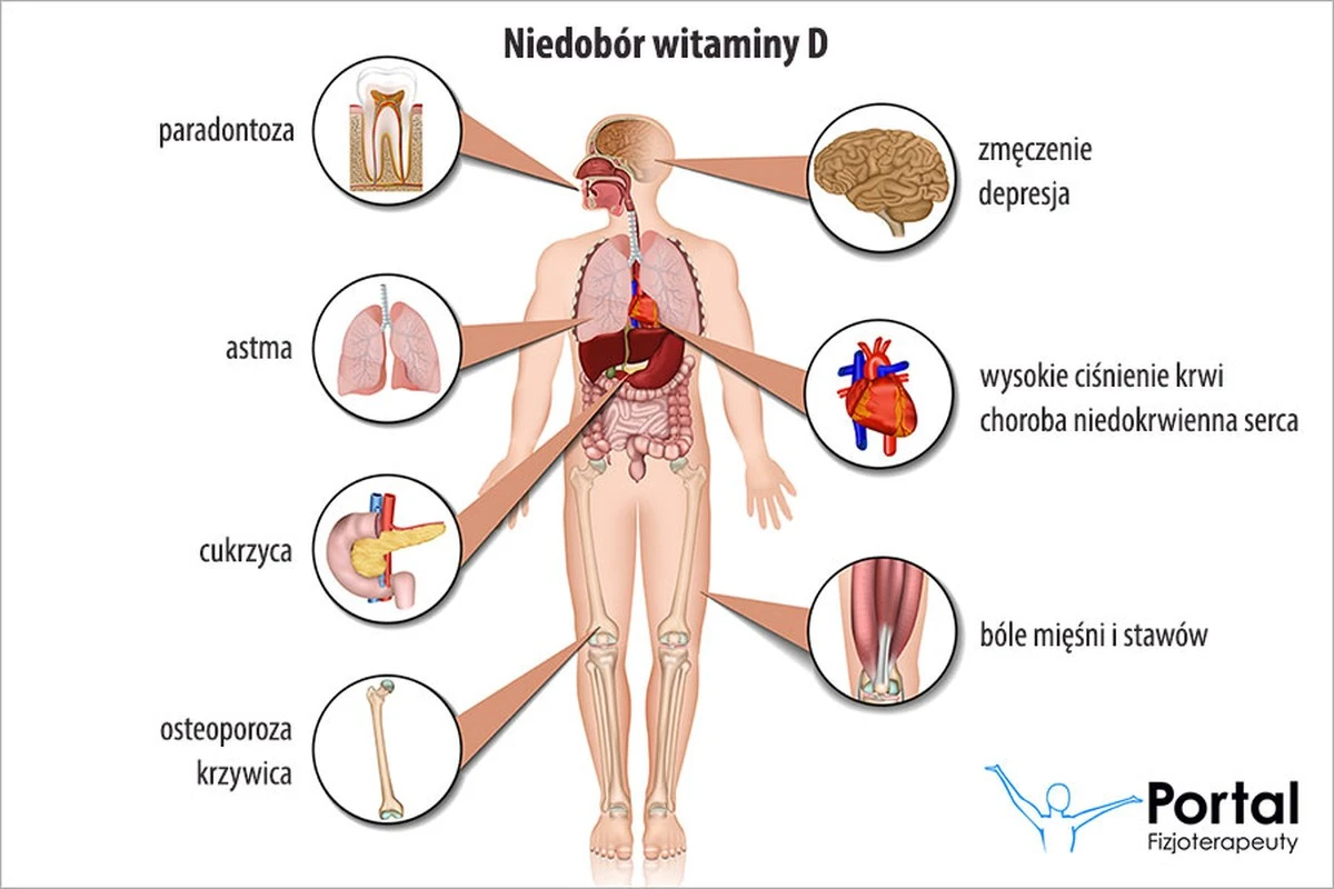 niedoborwitamin-extra-1.webp Niedobór witaminy D: 4 nieoczekiwane objawy, które musisz znać - image 1