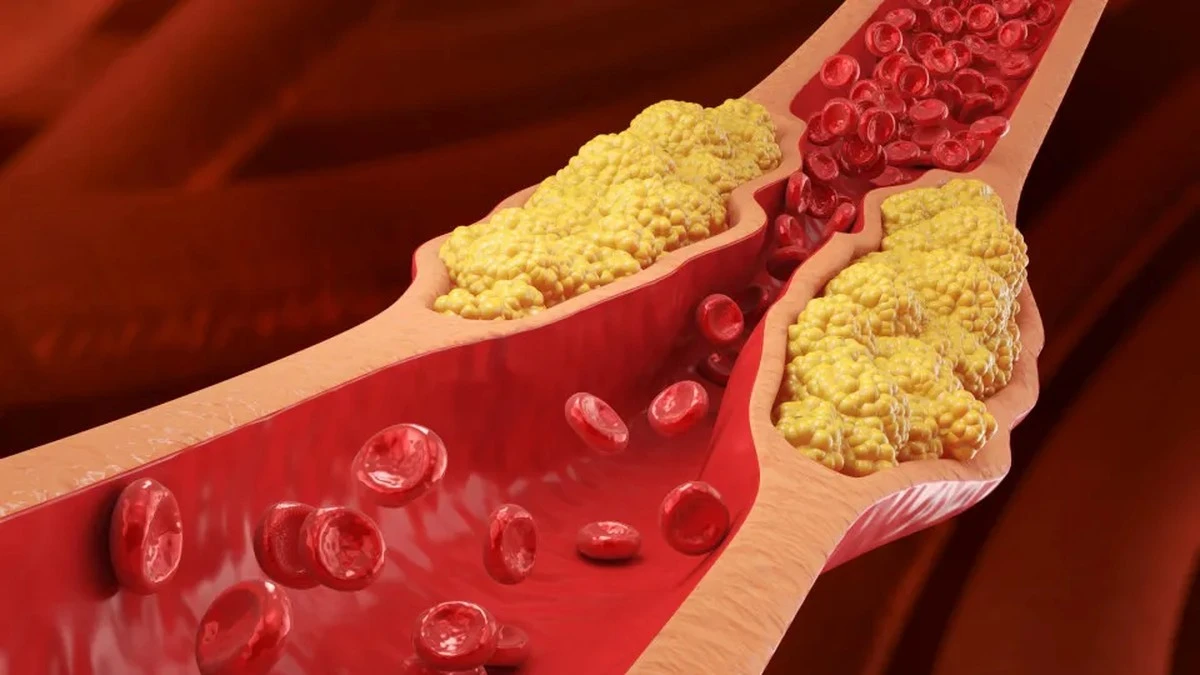 Pięć śniadań, które obniżą Twój cholesterol – lekarze nie chcą, byś o tym wiedział