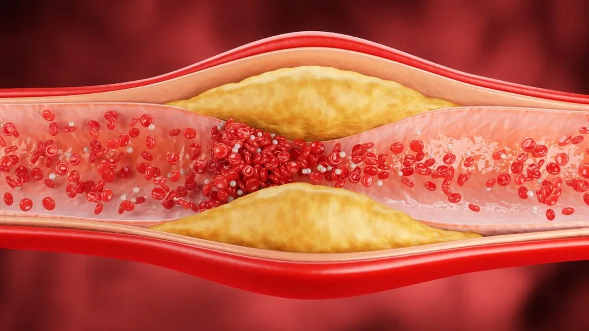 Zapiekanka z fasoli i sardynek? Niespodziewane puszki, które obniżają cholesterol