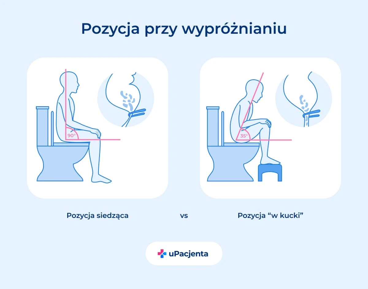 3produktyktorel-extra-1.webp 3 produkty, które lekarz polecił zamiast recepty na zaparcia – i zadziałały! - image 1